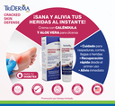 Triderma-Cracked-Skin-Defense-out.webp