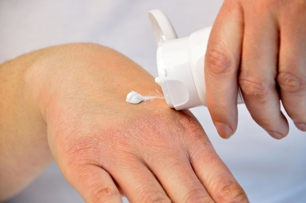 dry skin shutterstock_789226498.webp